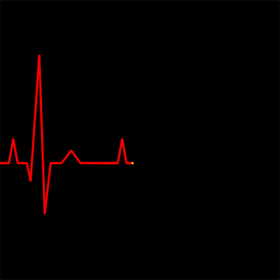 Bioresonance-EEG-heartbeat.gif