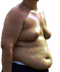 man-boobs-overweight.jpg