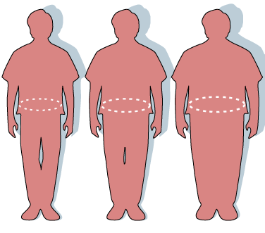 Obesity-waist_circumference.PNG
