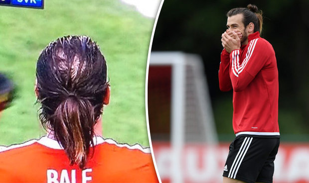 Gareth-Bale-bald-spot-Wales-528115.jpg